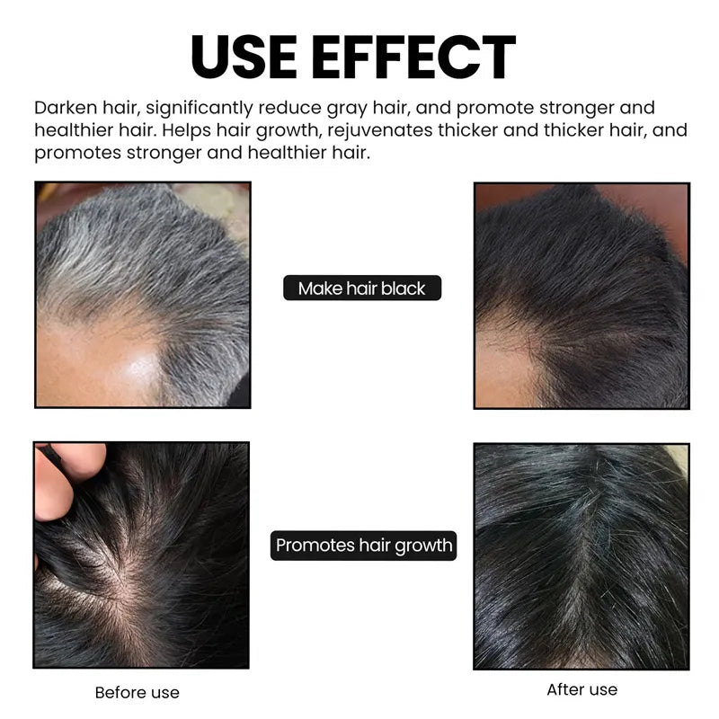 Shampoo Escurecedor de Cabelo e Barba-1 Pure Hair -